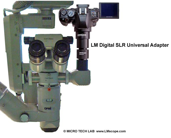 Clic en la imagen para ver su versin completa. 

Nombre: Microscope_Adapter_for_Zeiss_OPMI.JPG 
Visitas: 5481 
Tamao: 101.8 KB 
ID: 4846